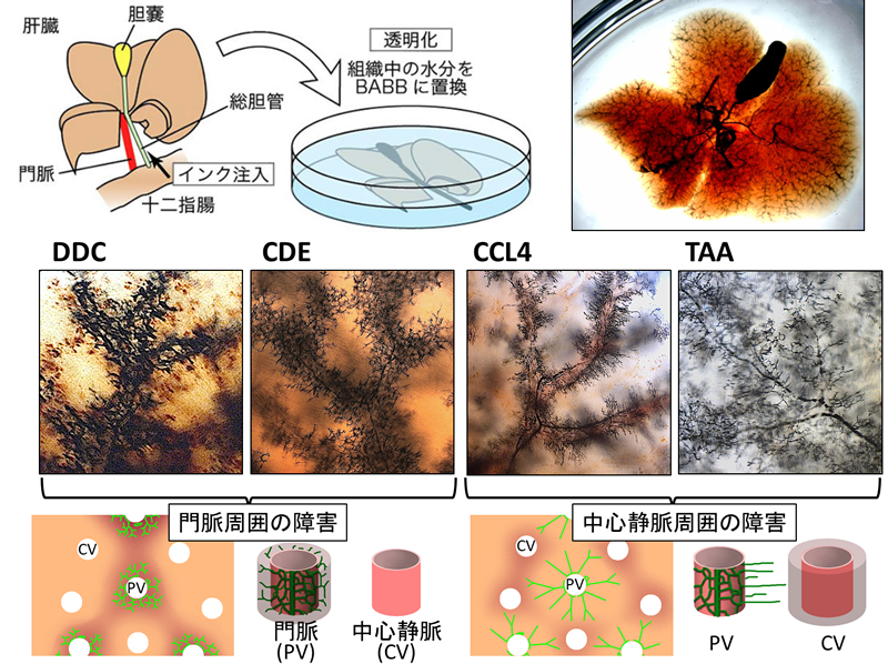 図2 胆管の樹状構造の可視化