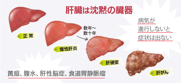 図 ウイルス性肝炎