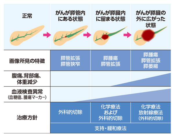 図 膵臓がん