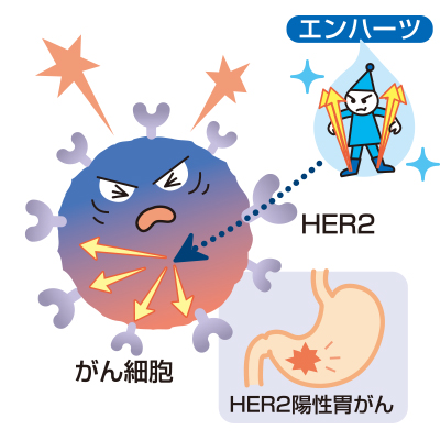 BRCA1/2変異とは