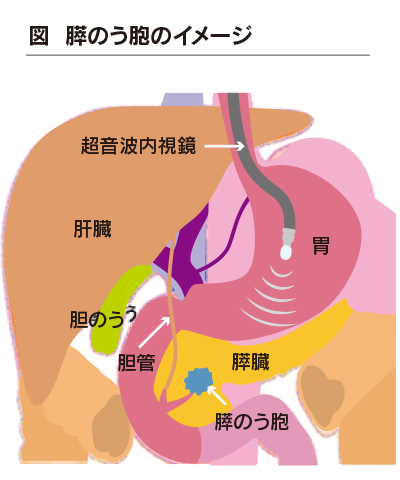 図